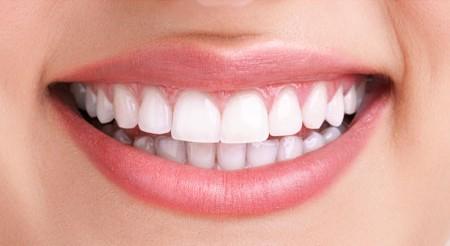 Before Teeth Whitening